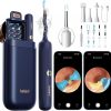 Amazon : $22.99 ($51.10)   Ear Wax Removal Tool Camera, Visible Ear Cleaner Earwax Remover Kit with Tweezers, Flexible Ear Scope Otoscope with Light, Portable Cleaning Kit Earpick for Adults & Kids